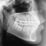Radiologia Odontológica em Alagoinhas