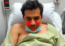 Raoni está consciente, mas apresenta leve piora no quadro renal
